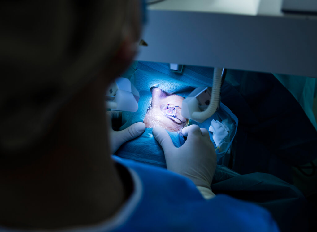 Close up shot of a patient undergoing a cataract operation