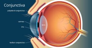 Conjunctiva