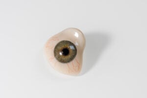 Prosthetic Eye: Surgery, Costs and Care