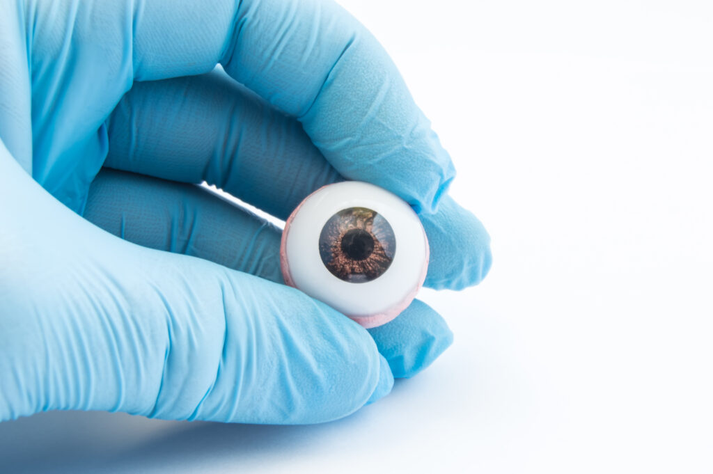 Prosthetic eye held by a surgeon wearing medical gloves