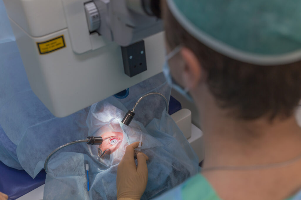 Trabeculoplasty being performed by the eye doctor to a female patient