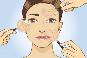 How to Get Rid of Eye Wrinkles