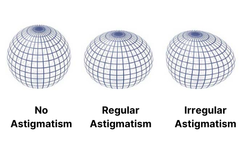 Astigmarism sphere edited