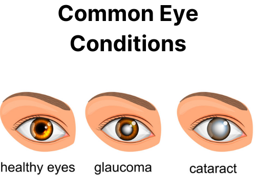 Refractive errors common eye conditions edited